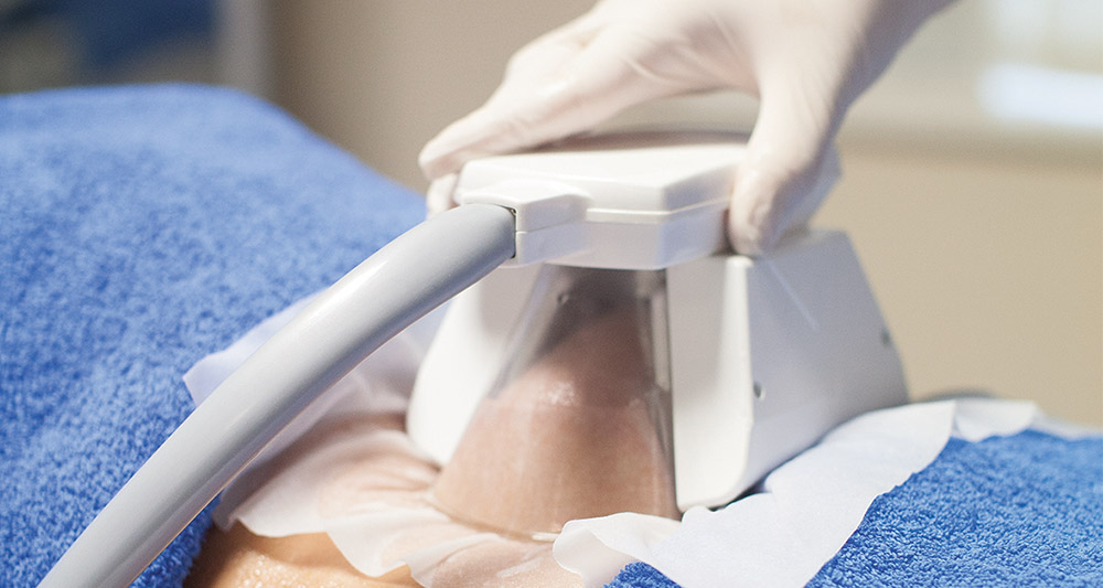 How Fat Freezing and HIFU Work Together? 2 Multiple Areas in One Session HIFU and Fat Freezing Southall