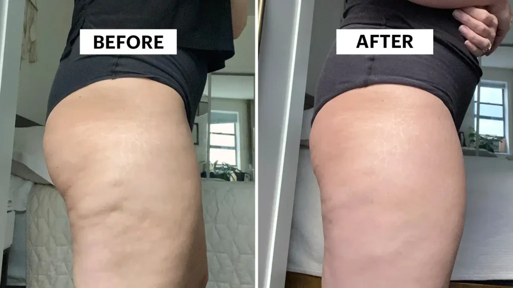 Sculpting Your Bum: Can Toning Exercises Really Reduce Cellulite? 1 Do Toning Exercise Southall Really Tackle Cellulite?