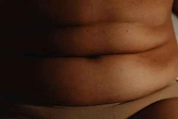 The Hidden Connection: How Stress Shapes Your Fitness and Body Composition 3 image of what stress can do on the stomach area and how Lipo 360 Southall can help to change your body shape.